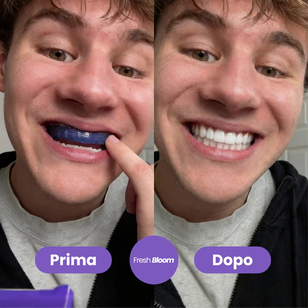 FreshWhite™ Strisce Sbiancanti per Denti Effetto Anti-Giallo